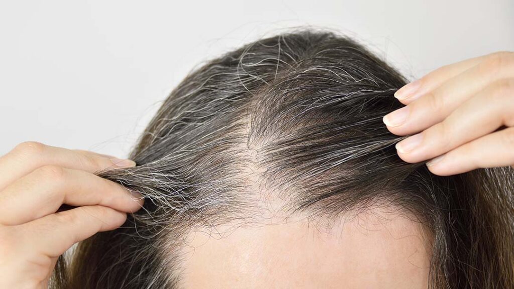 Hair Restoration for Women with Cold Therapy Treatments – Call (203) 601-7772