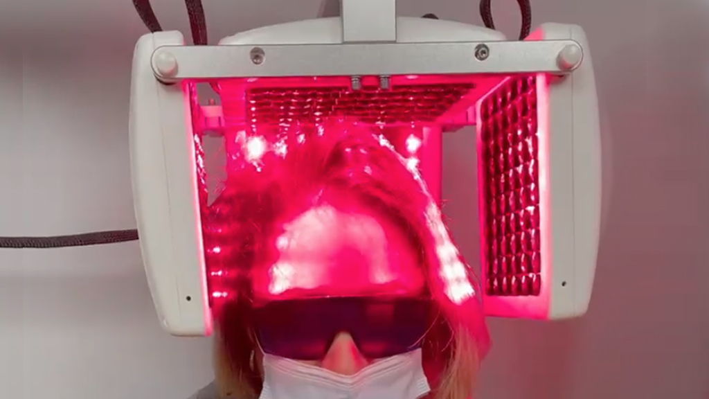 woman is receiving laser therapy for hair loss red light surrounds her head wearing block protective glasses