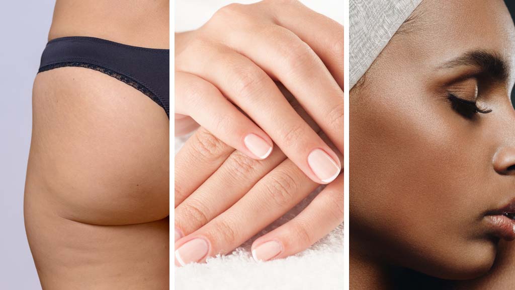 three images showing hands, face and thighs which are areas that skin rejuvenation can treat
